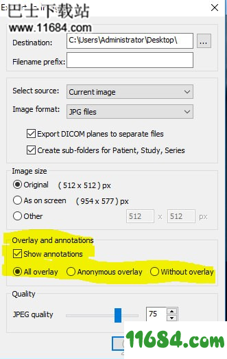 MicroDicom viewer下载-Dicom格式看图软件MicroDicom viewer v2.9.2 最新版下载